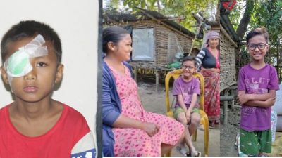 जन्मजात मोतियाबिन्दु भएका १० वर्षीय सागरको निःशुल्क शल्यक्रिया पछि फेरियो दैनिकी